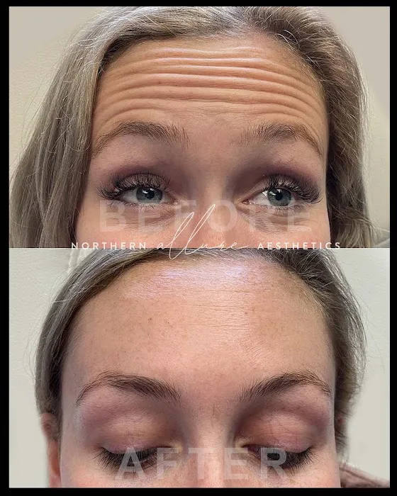 Northern Allure Aesthetics Picture 10