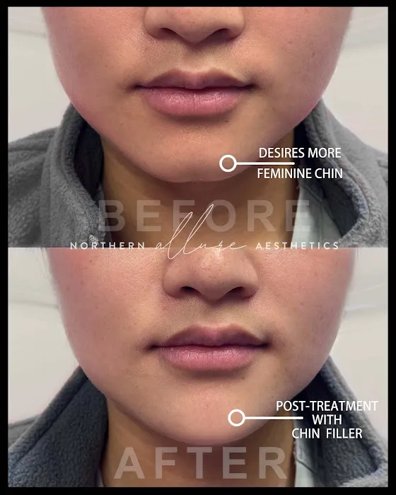 Northern Allure Aesthetics Picture 7