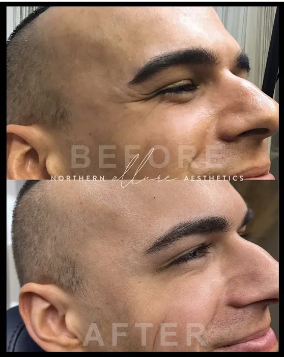 Northern Allure Aesthetics Picture 8