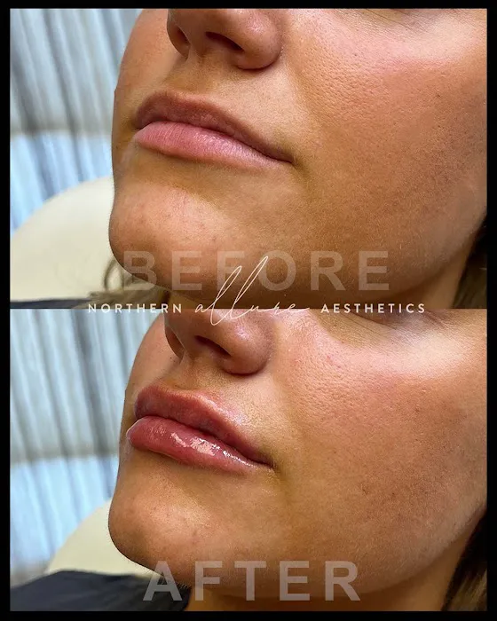 Northern Allure Aesthetics Picture 9