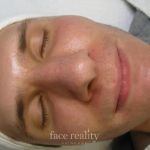 Amira Acne Solutions