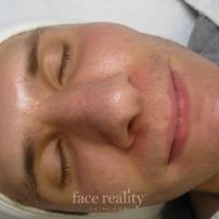 Amira Acne Solutions ico