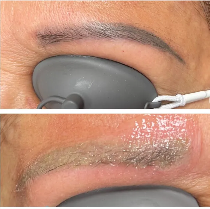 Blix Clinical Aesthetics & Laser Picture 10