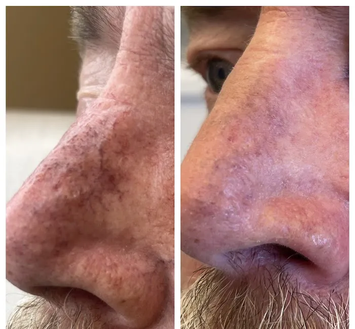 Blix Clinical Aesthetics & Laser Picture 9