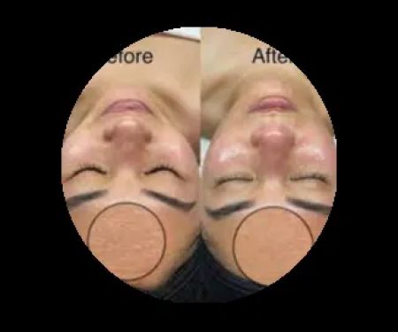 Aging Gracefully Skincare Experts