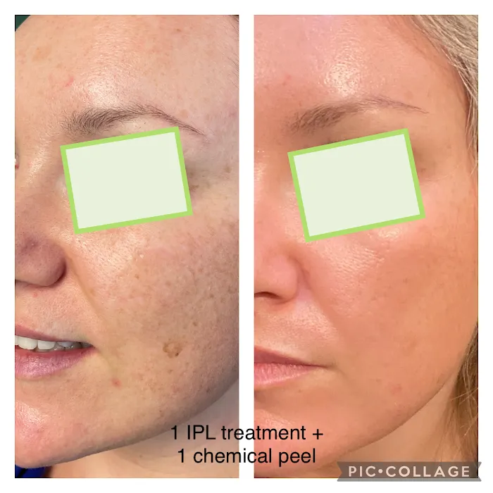 Technique Skincare Picture 8