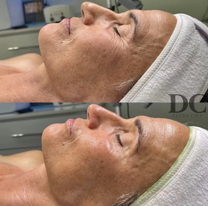 DC Esthetics Picture 10