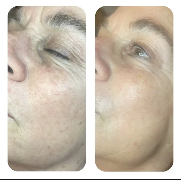 Mary Conway Skin Care Picture 8