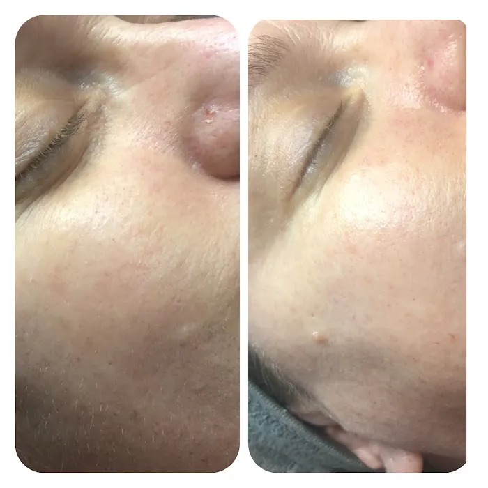 Mary Conway Skin Care Picture 7