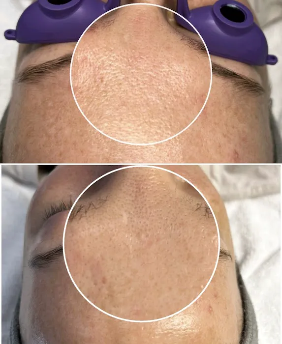 Skin Nova Seattle Picture 3