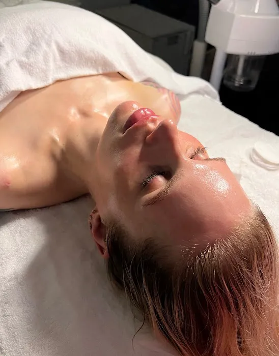 Skin Nova Seattle Picture 9