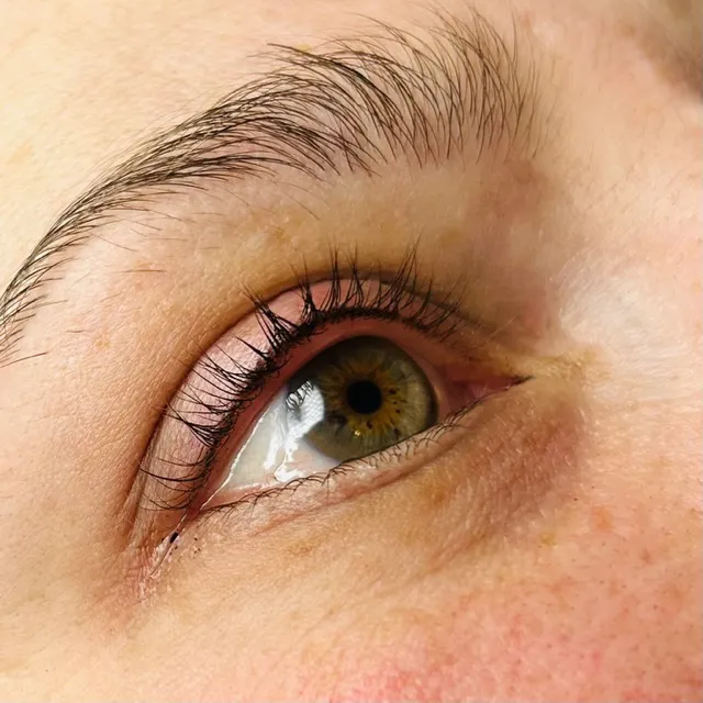 The Skin Firm Picture 2