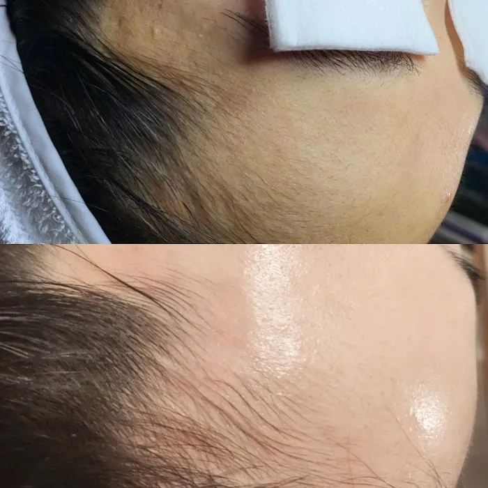 LoAh Skin Care Picture 8