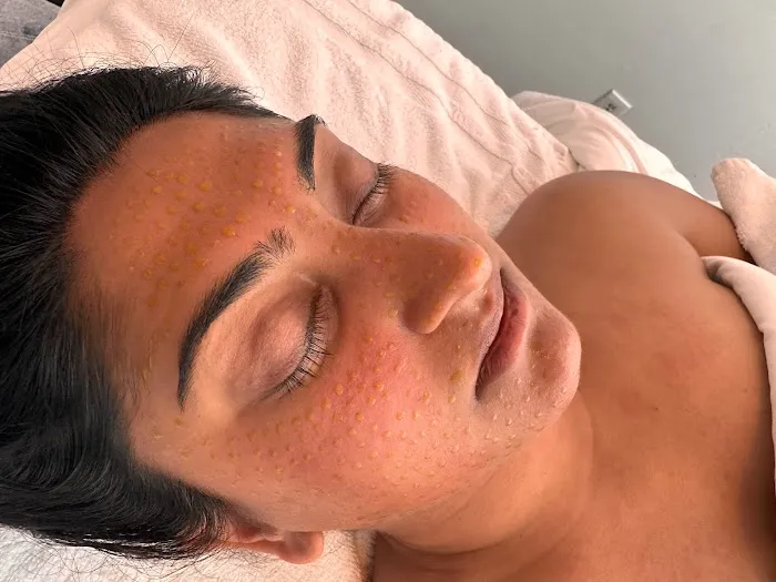 Golden Bubble Skin Picture 10