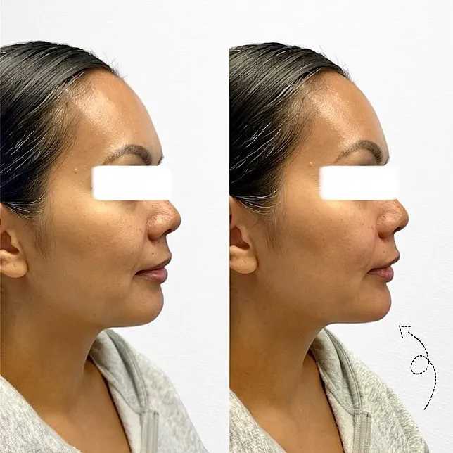 Mahal Aesthetics, PLLC Picture 10