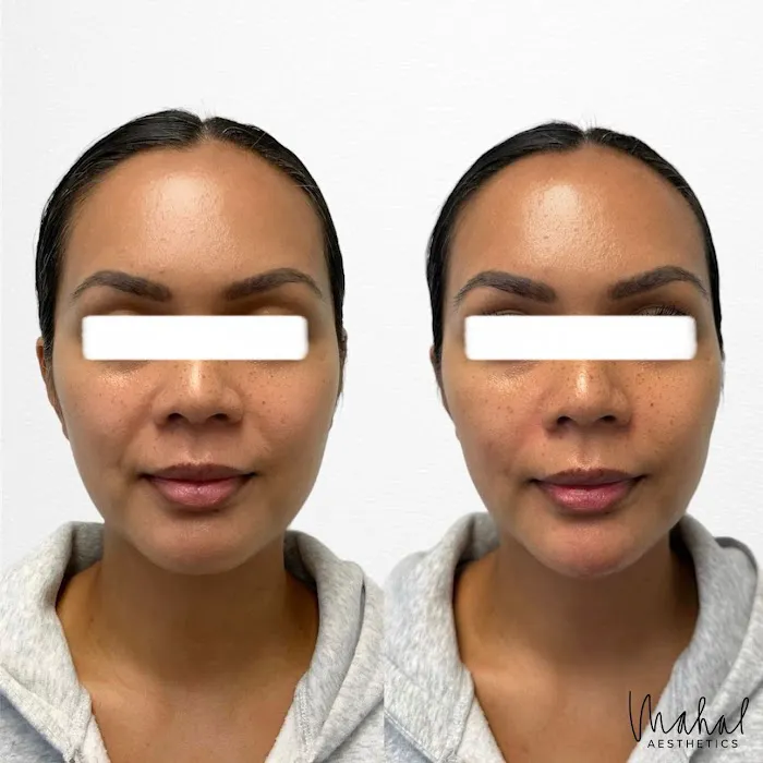 Mahal Aesthetics, PLLC Picture 9