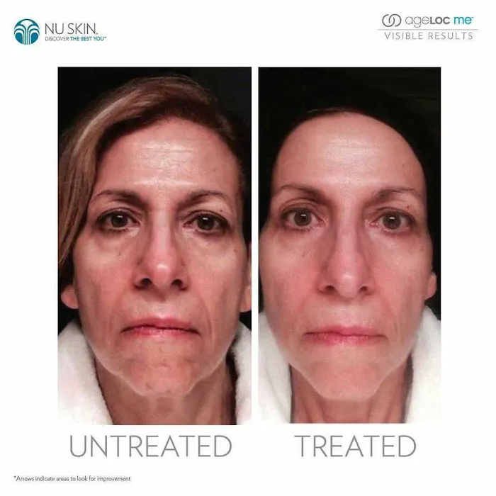 Advanced Anti-aging Picture 6