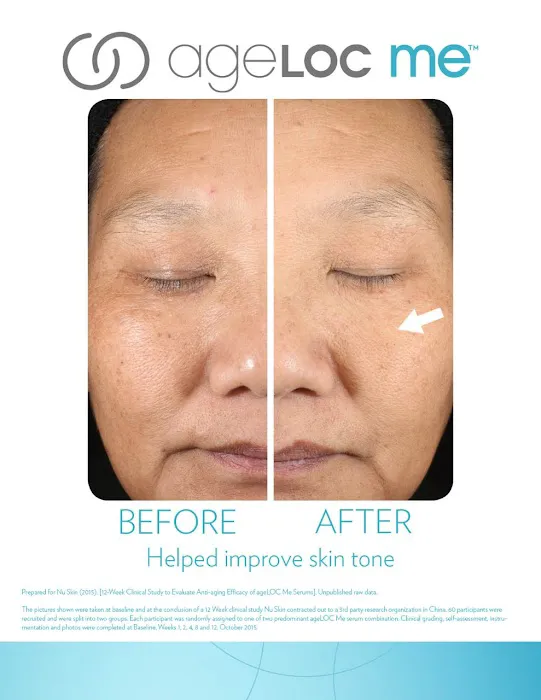 Advanced Anti-aging Picture 8