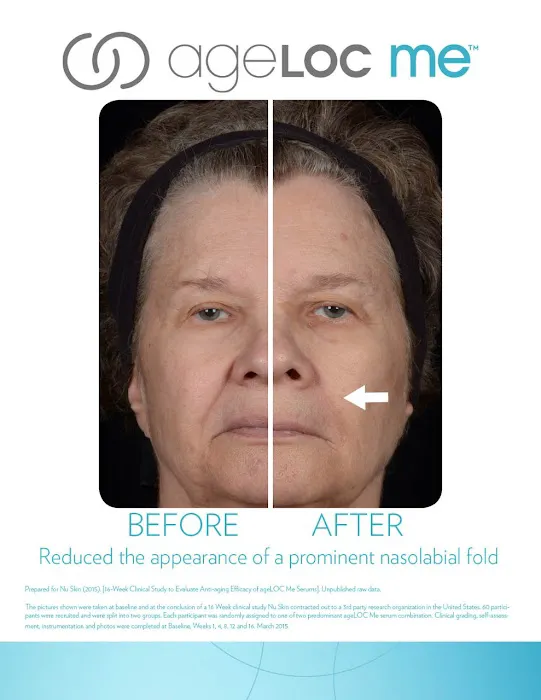 Advanced Anti-aging Picture 7