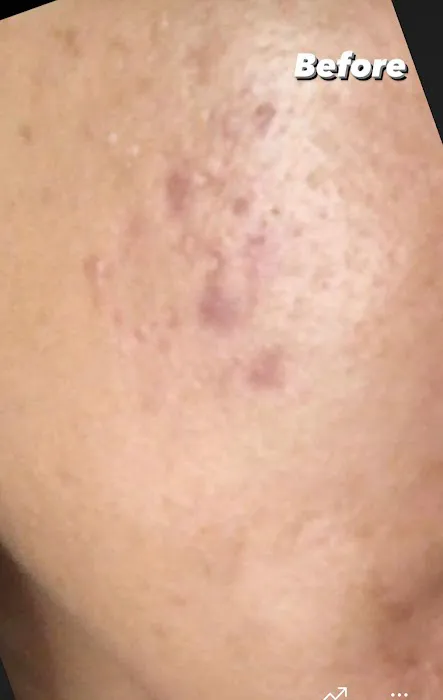 Dikaro Aesthetics Salon and Spa Picture 8