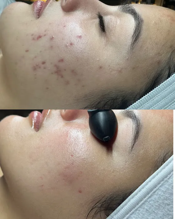 The Skin Bar | Bellevue Sugaring & Skincare Picture 4