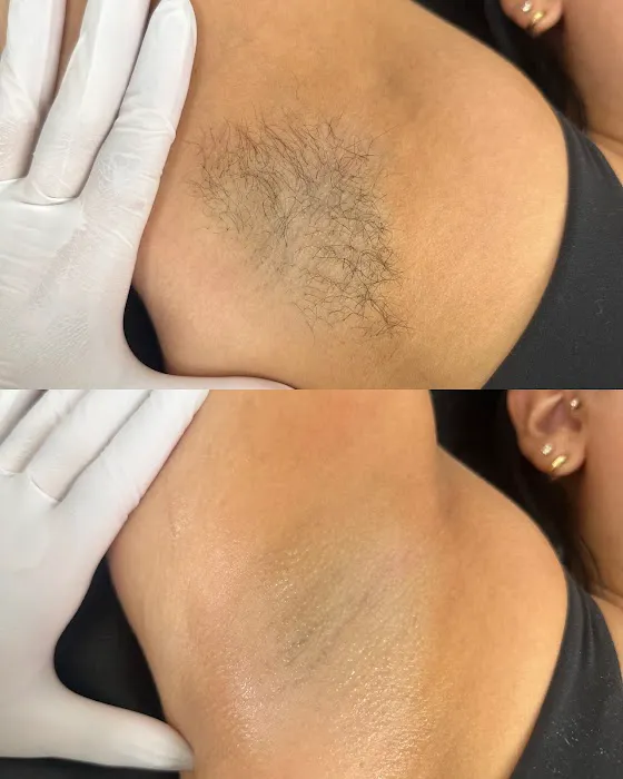 The Skin Bar | Bellevue Sugaring & Skincare Picture 6