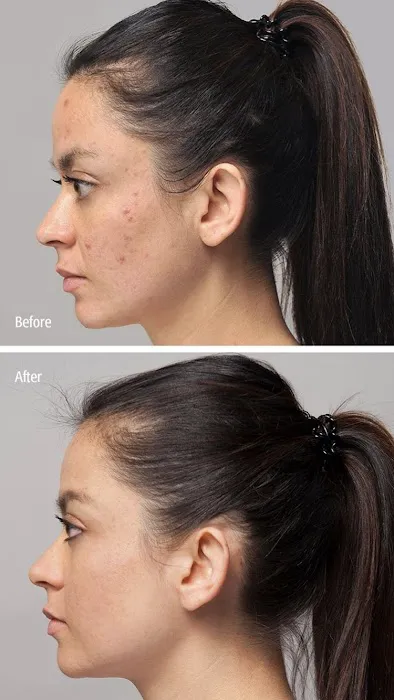 Jacqueline Skincare Picture 6