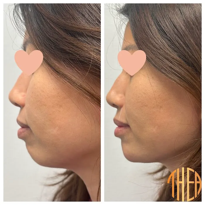 Thea Aesthetic Picture 3