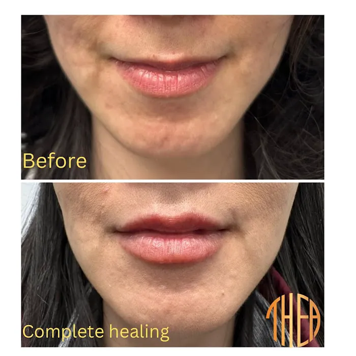 Thea Aesthetic Picture 6