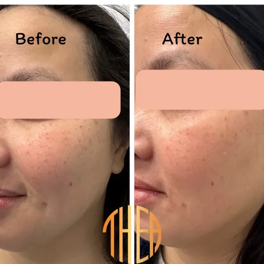 Thea Aesthetic Picture 5