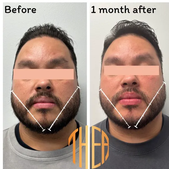 Thea Aesthetic Picture 4