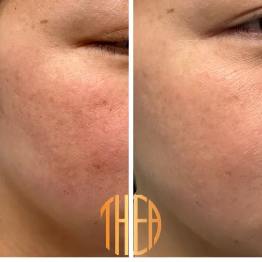 Thea Aesthetic Picture 9