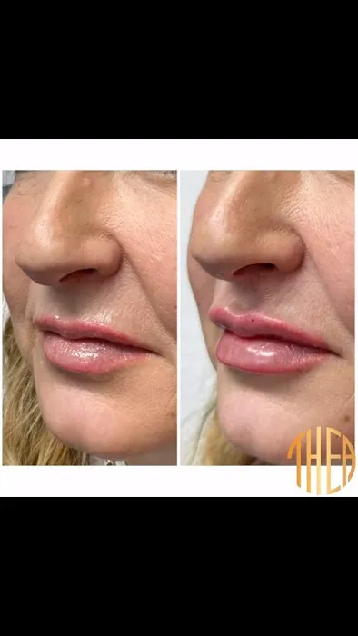 Thea Aesthetic Picture 7