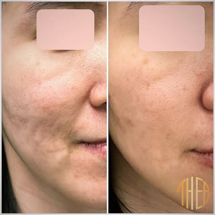 Thea Aesthetic Picture 10