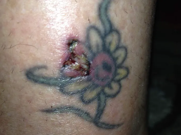 Aura Laser Skin Care Picture 10