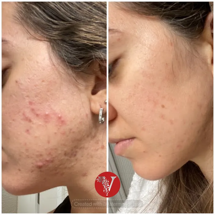 V Facial Beauty LLC Picture 4