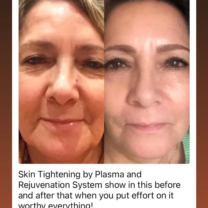 V Facial Beauty LLC Picture 6