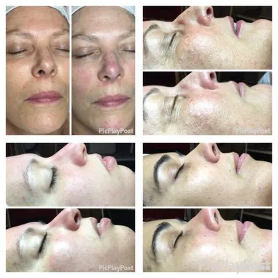 V Facial Beauty LLC Picture 7