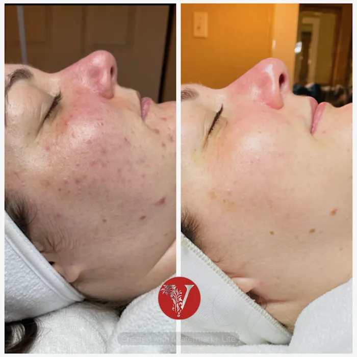 V Facial Beauty LLC Picture 5