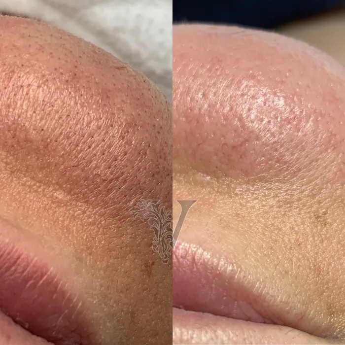 V Facial Beauty LLC Picture 10