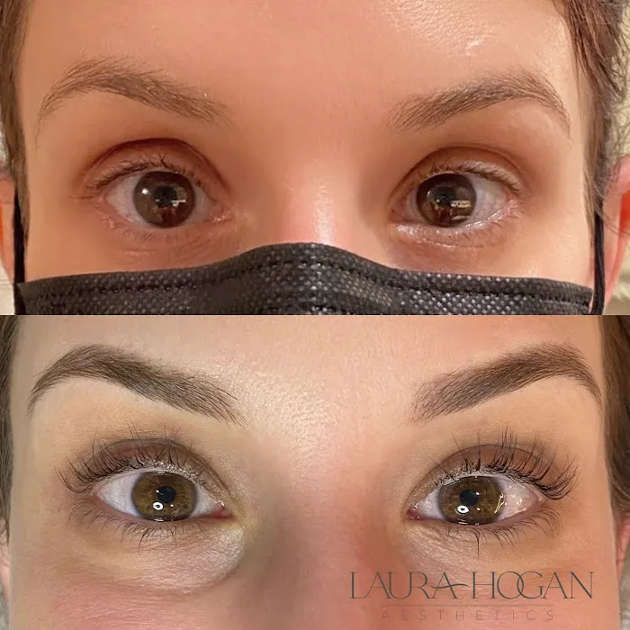 Laura Hogan Aesthetics Picture 5