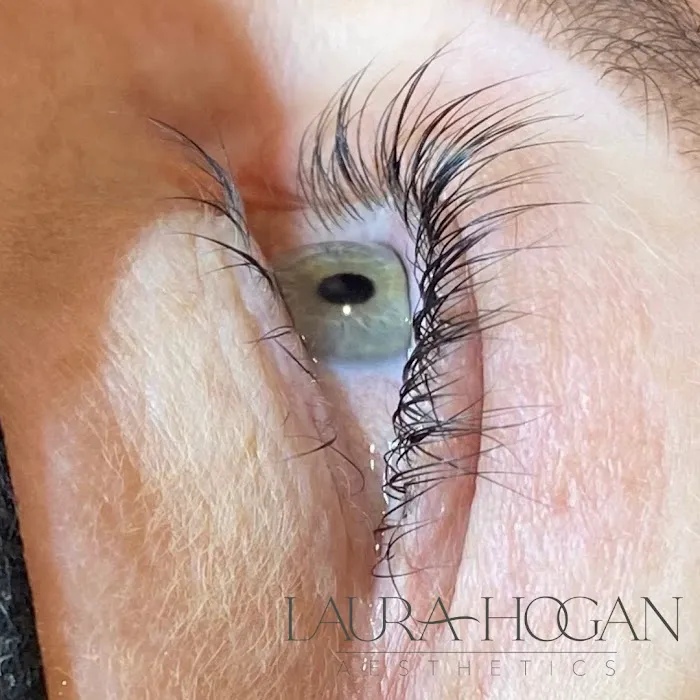 Laura Hogan Aesthetics Picture 7