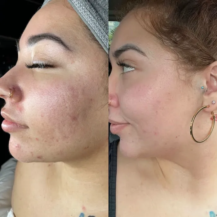 Kenzthetics Picture 8