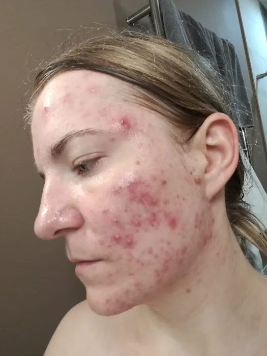 Naturopathic Dermatology Picture 2