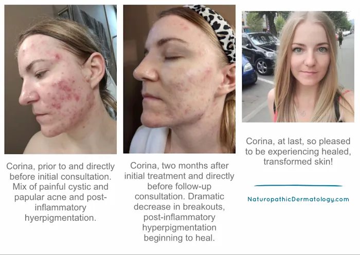 Naturopathic Dermatology Picture 5