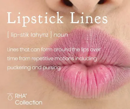 Alaana Derm Picture 3