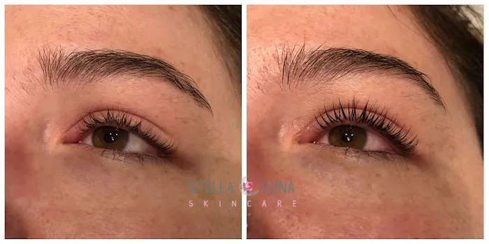 Stella Luna Skincare Picture 1