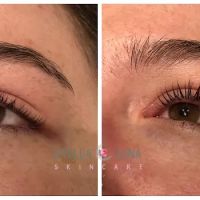 Stella Luna Skincare ico