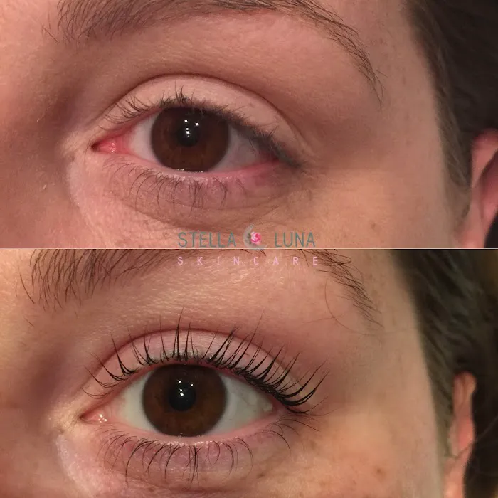 Stella Luna Skincare Picture 8