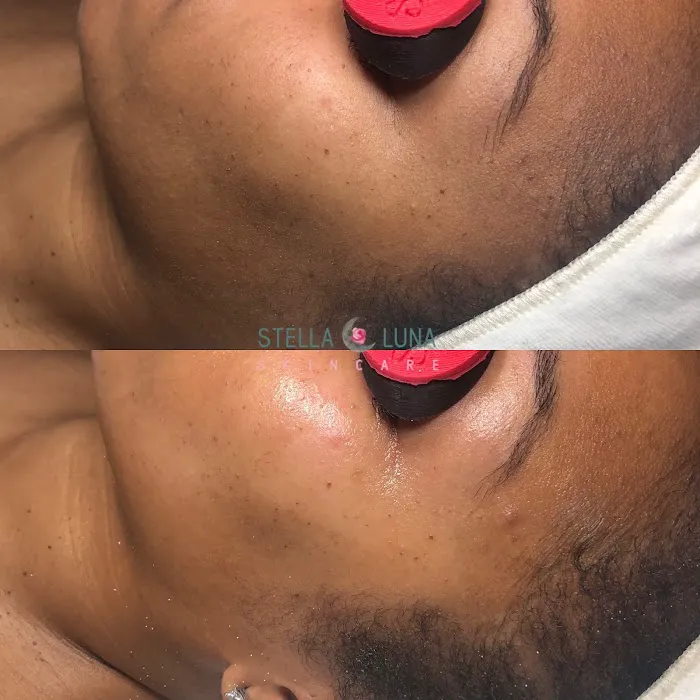 Stella Luna Skincare Picture 9